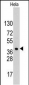 HDGF Antibody (C-term)