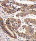 PKC zeta Antibody (N-term)