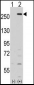 LMTK2 Antibody (Center)