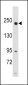 RICTOR Antibody (N-term)