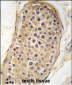 RICTOR Antibody (N-term)