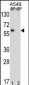 BBS4 Antibody (Center)