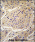 Caspase-3 (CASP3) Antibody (Center)