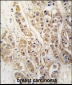 CLIC4 Antibody