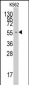 FARSA Antibody (N-term)