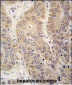 HARS Antibody (N-term)
