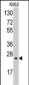 SOD2 Antibody