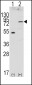 FGFR4 Antibody