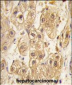 PDGFRB Antibody