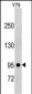 PDGFRB Antibody