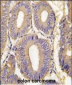 PAK1 Antibody (T423)