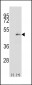 MEK1 (MAP2K1) Antibody (S218)