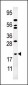 AK1 Antibody (N-term)