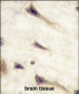 EPHA5 Antibody