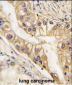 EPHB2 Antibody