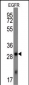 EGFR Antibody (Ascites)