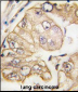 VGFR3 Antibody