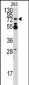 ZNF219 Antibody (N-term)
