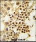 GDF3 Antibody (Center)
