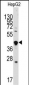 GDF3 Antibody (Center)