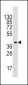 ALDOA Antibody (C-term)