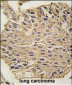ALDOA Antibody (C-term)