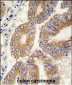 S adenosylhomocysteine hydrolase (ACHY) Antibody (C-term)