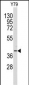 AKR1A1 Antibody (C-term)