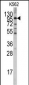 LGR5 (GPR49) Antibody (Center)