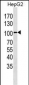 LGR5 (GPR49) Antibody (Center)