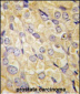 FZD1 Antibody (Center)