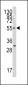 TRF (TERF1) Antibody (C-term)