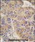UGP2 Antibody (C-term)