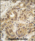 ZIC3 Antibody (N-term)