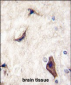 RASGRF1 Antibody (S929)