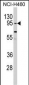 CLOCK Antibody (Center)