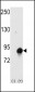 Cullin 4A (CUL4A) Antibody (N-term)