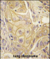 EphB2 Antibody