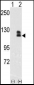 EphB2 Antibody