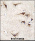 TYRO3 Antibody