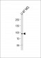 TYRO3 Antibody