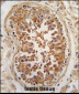 ULK3 Antibody (N-term)