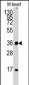 ULK3 Antibody (N-term)