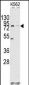 JHDM1a/FBXL11 Antibody (C-term)