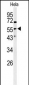 Vimentin Antibody (S82)