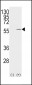 Vimentin Antibody (S82)