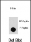 Phospho-Desmin(T16) Antibody