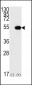 p53 Antibody (S15)