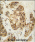 CDK2 Antibody (T14)