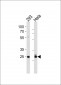 CDK2 Antibody (T14)